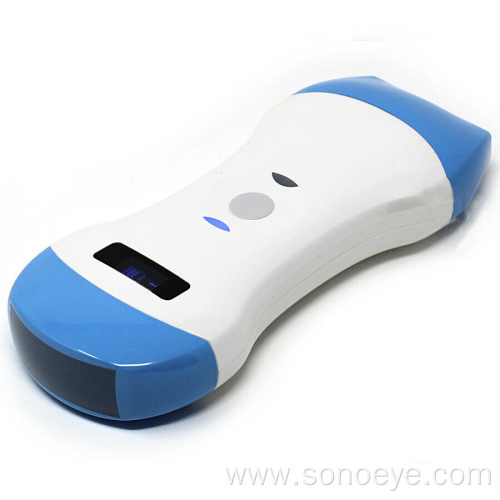 SONOSTAR UProbe Wireless Probe Ultrasound